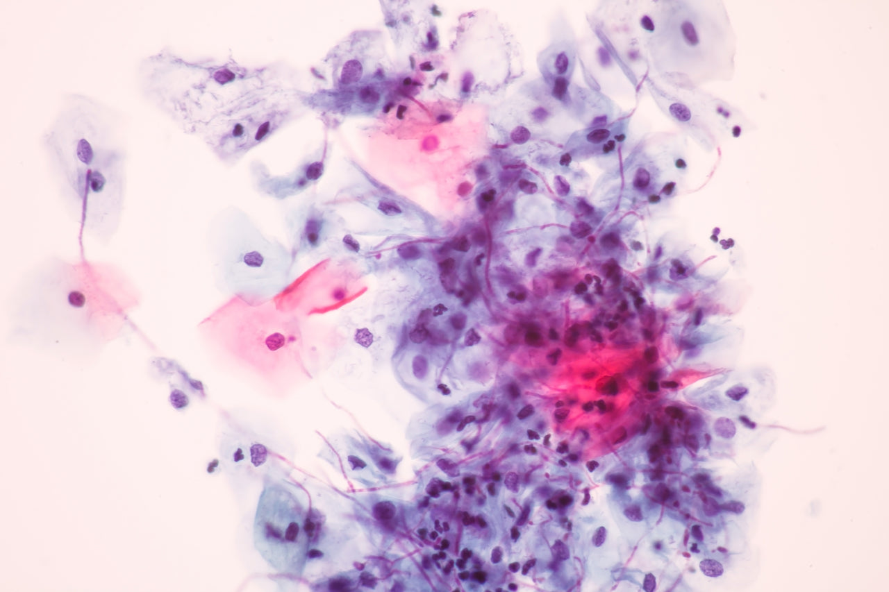 Et si vos problèmes de poids étaient dus au Candida albicans ?