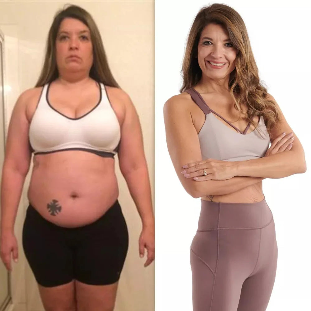 Before/After