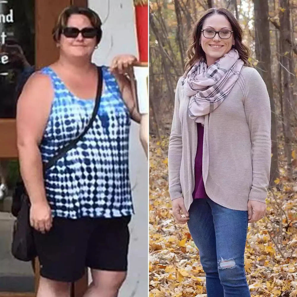 Before/After