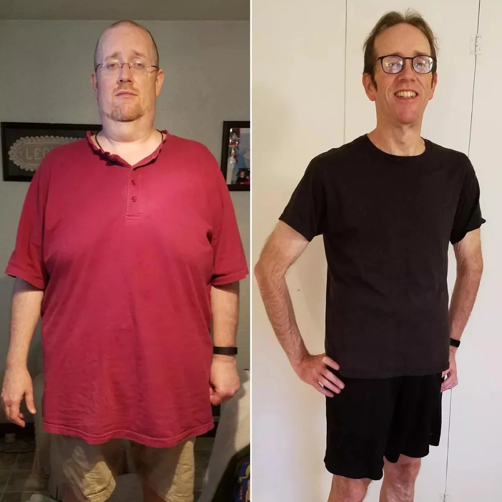 Before/After