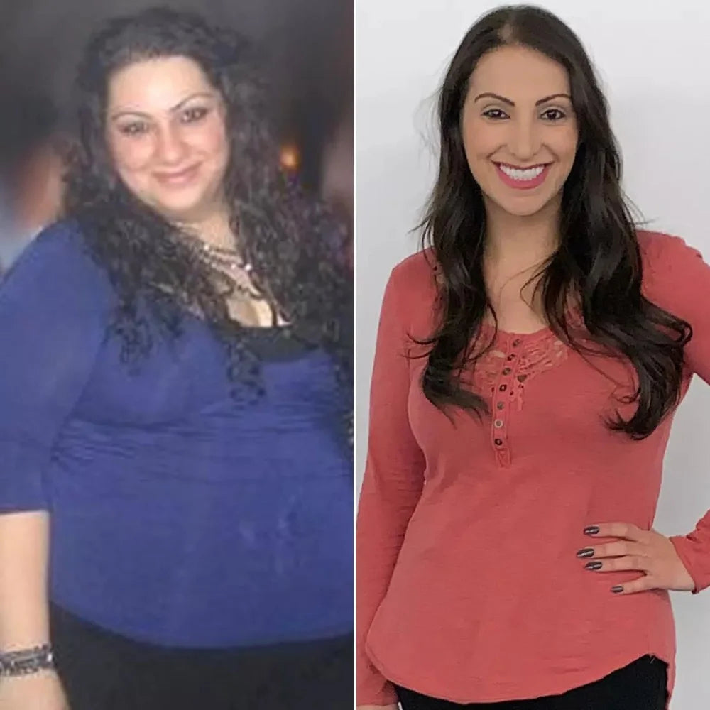 Before/After